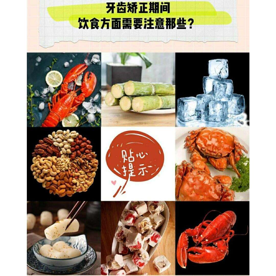 九游体育官网首页-关于电竞选手饮食揭秘：比赛期间吃什么能提升状态？的信息